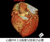 心臓画像診断